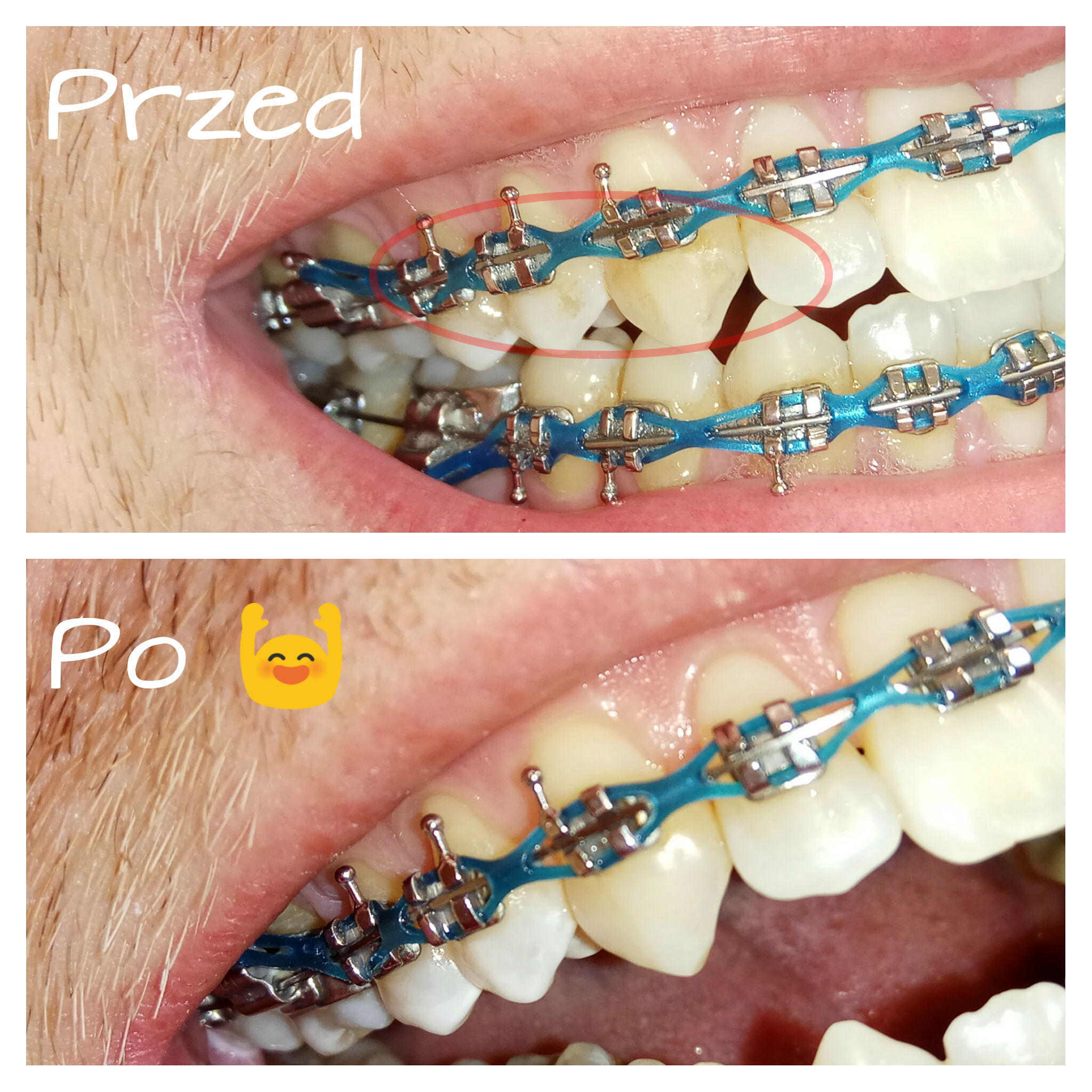 301 Moved Permanently 301-moved-permanently