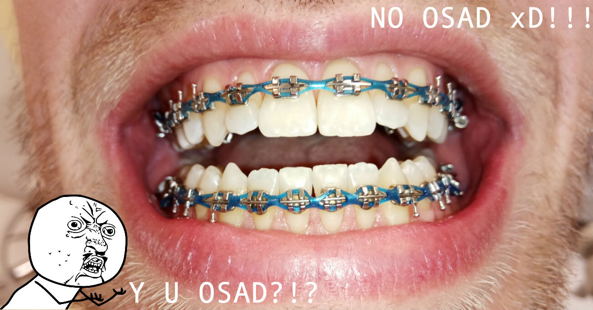 Aparat ortodontyczny a osad na zębach