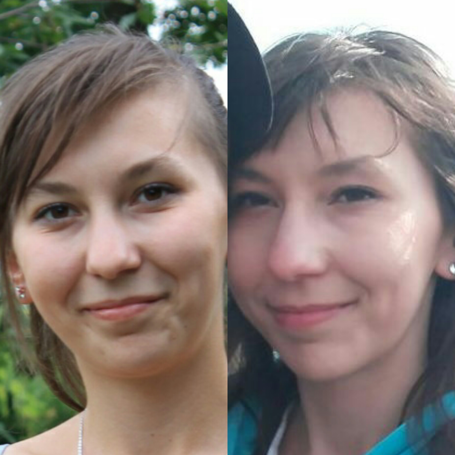 Magda przed i po leczeniu ortodontycznym